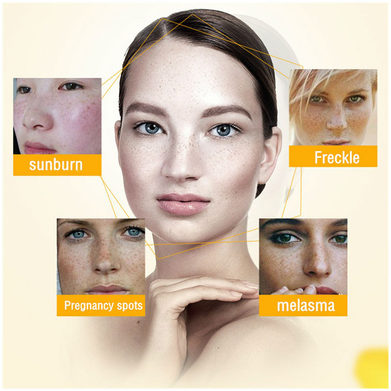 Dimollaure Whitening Freckle C - Retinol Cream recension och pris