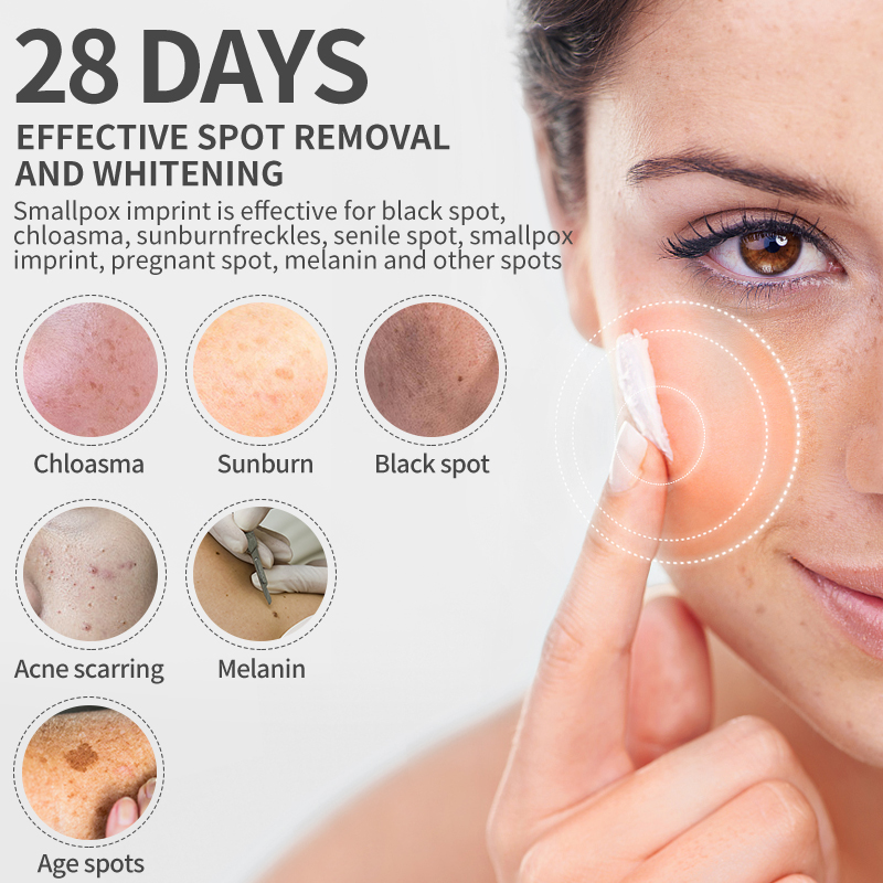 Dimollaure Whitening Freckle C - Retinol Cream recension och pris